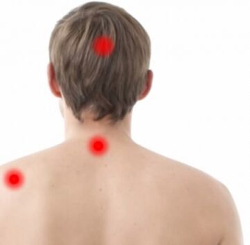 Rebaño de osteocondrosis