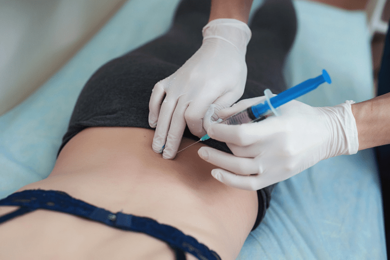 Bloqueo en la osteocondrosis lumbar